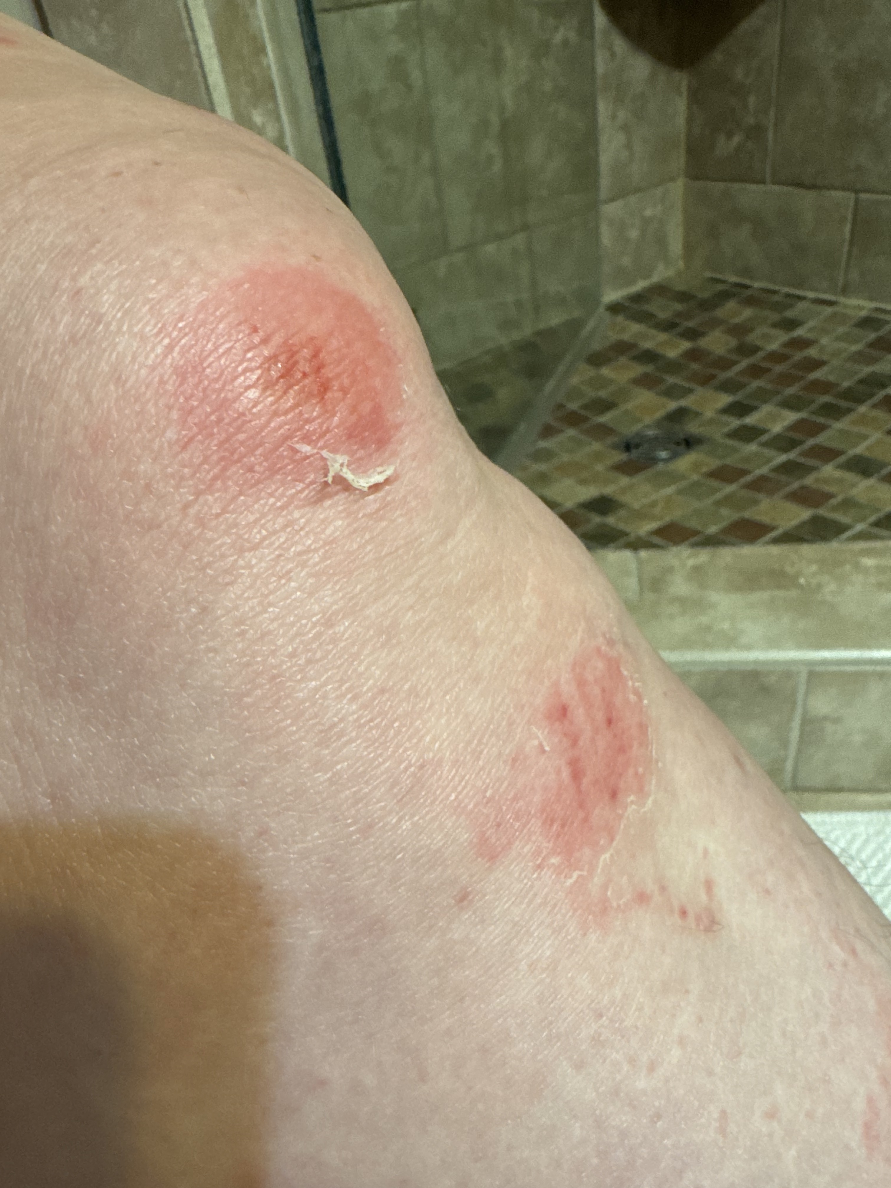 Monroe Rd, Charlotte to Kirkpatrick Rd, Charlotte